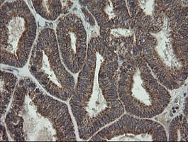 FAM164A / CGI-62 Antibody (clone OTI4C1)