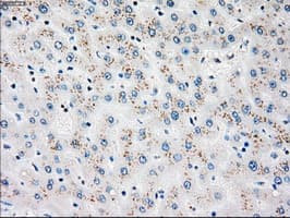Monoclonal Mouse anti-Human PLK1 / PLK-1 Antibody (clone OTI3F12, IHC, WB)