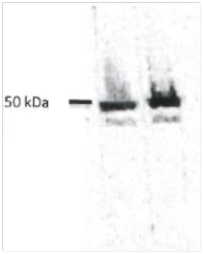IHC-plus™ KRT8 / CK8 / Cytokeratin 8 Antibody (clone M20)