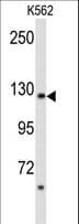 Polyclonal Rabbit anti-Human PLCB2 Antibody (aa174-202, IHC, WB)