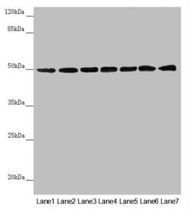 UQCRC1 Antibody