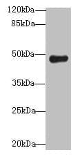 IHC-plus™ Polyclonal Rabbit anti-Human RNF128 / GRAIL Antibody (IHC, WB)