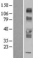 SLC43A3 Protein (Over-Expression Lysate Myc-DDK (Flag))