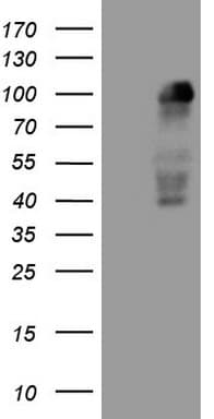 Monoclonal Mouse anti-Human MED15 / ARC105 Antibody (clone OTI1D5, Carrier-free, aa393-679, IHC, WB)