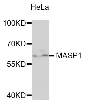 MASP1 / MASP Antibody