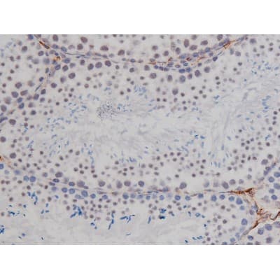 NPM1 / NPM / Nucleophosmin Antibody (phospho-Thr199)