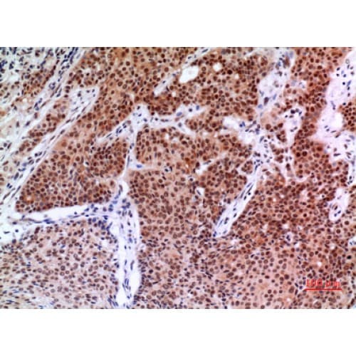 Polyclonal Rabbit anti-Human HIF2A / EPAS1 Antibody (380-420 aa, IHC, IF, WB)