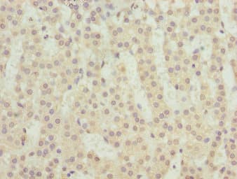 TM9SF1 Antibody