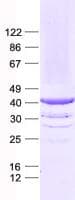 Human EBNA1BP2 Protein (Recombinant His, N-Terminal)