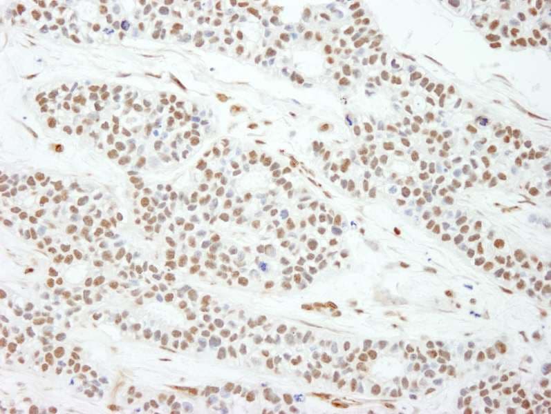 MAD2L1 / MAD2 Antibody (aa100-150)