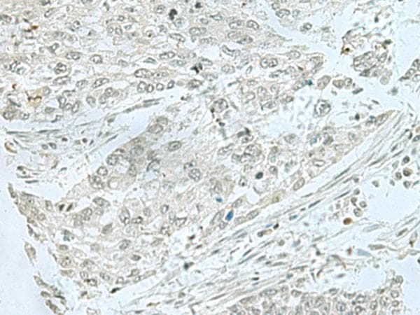 THTPA Antibody