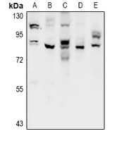 Polyclonal Rabbit anti-Human CHPF2 / CSGLCAT Antibody (IHC, WB)
