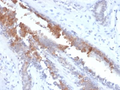 SCGB2A2 / Mammaglobin A Antibody (clone MGB1/2123R, Azide-free, Carrier-free)