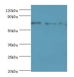 AKAP10 Antibody (aa413-662)