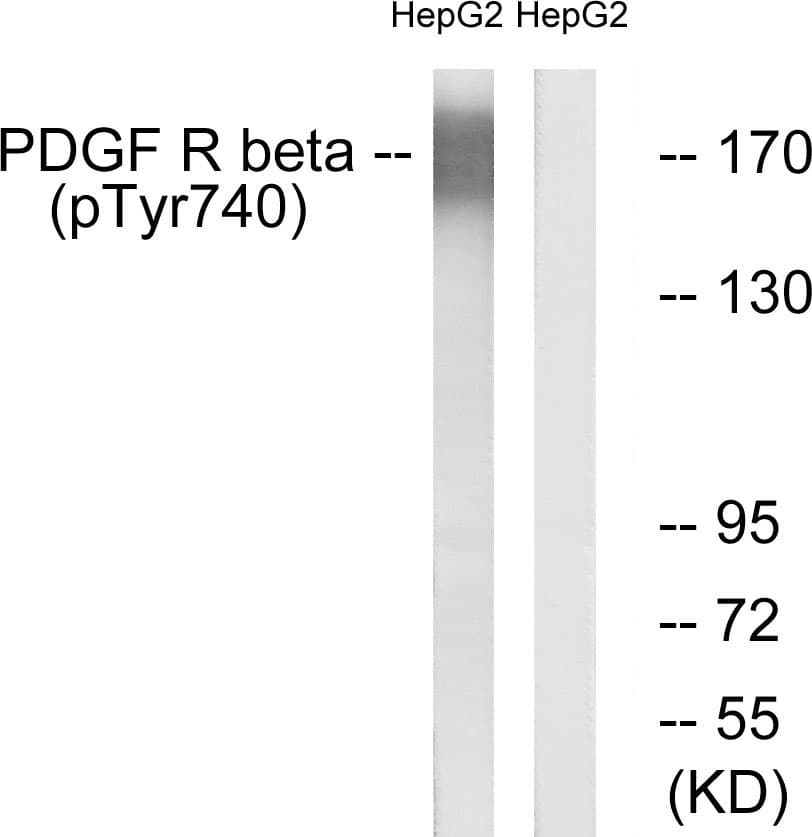 Polyclonal Rabbit anti-Human PDGFRB / PDGFR Beta Antibody (phospho-Tyr740, IHC, WB)