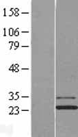 JOSD1 Protein (Over-Expression Lysate Myc-DDK (Flag))