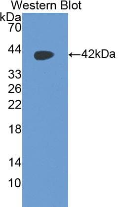 PTH / Parathyroid Hormone Antibody (aa26-115)