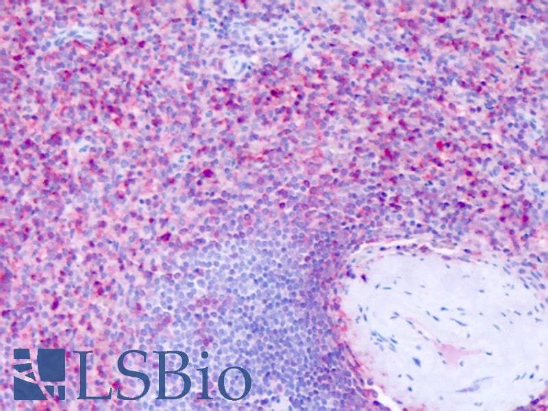 IHC-plus™ Polyclonal Rabbit anti-Human GPR63 Antibody (Cytoplasmic Domain, IHC)