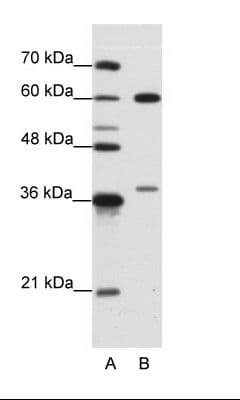 Polyclonal Rabbit anti-Human HNRNPL / hnRNP L Antibody (aa82-131, IHC, WB)