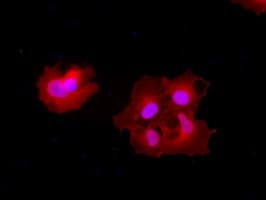 Monoclonal Mouse anti-Human CPA1 / Carboxypeptidase A Antibody (clone OTI2A3, IHC, IF, WB)