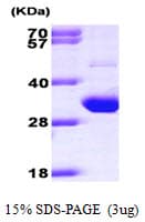 Human TIGAR Protein (Recombinant His)