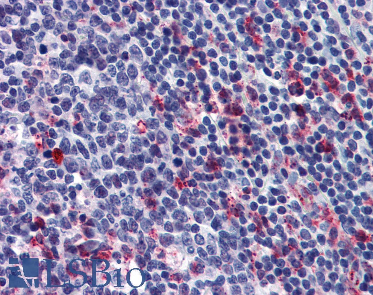IHC-plus™ FFAR2 / GPR43 Antibody (aa271-320)
