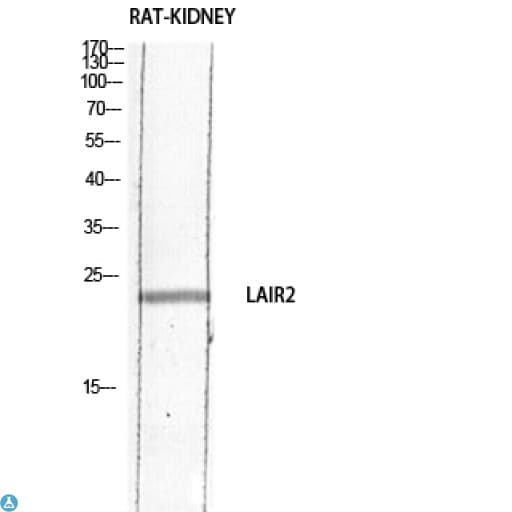 Polyclonal Rabbit anti-Human LAIR2 / CD306 Antibody (WB)