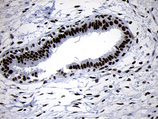 SMC1A / SMC1 Antibody (aa889-1016, clone OTI5A1)
