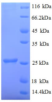 Human UBE2K / LIG Protein (Recombinant His)