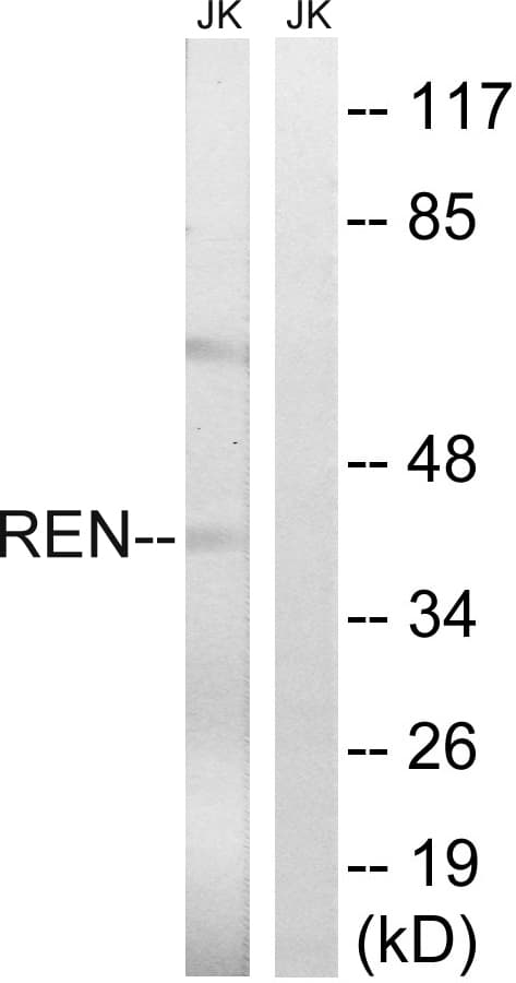Polyclonal Rabbit anti-Human REN / Renin 1 Antibody (aa207-256, WB)