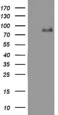 Monoclonal Mouse anti-Human ACE2 / ACE-2 Antibody (clone OTI4D2, aa18-237, IHC, WB)