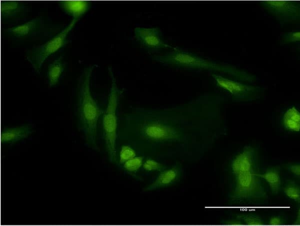 Monoclonal Mouse anti-Human PDE6D / PDE6 Delta Antibody (clone 4H6, IF, WB)