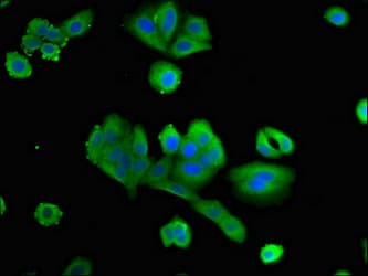 PTX3 / Pentraxin 3 Antibody