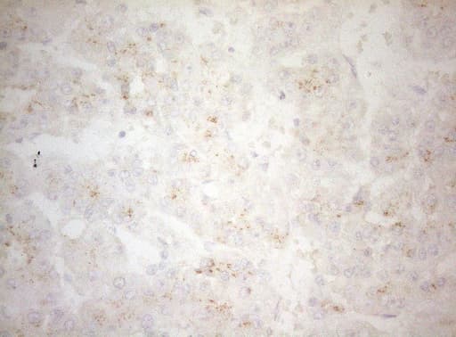 Monoclonal Mouse anti-Human CPM / Carboxypeptidase M Antibody (clone OTI2D11, aa124-423, IHC, WB)