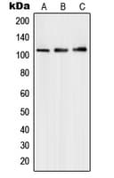 HPMS1 / PMS1 Antibody (Internal)