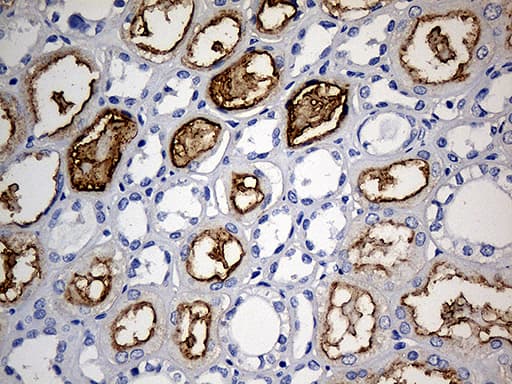 ACE / CD143 Antibody (aa642-1230, clone OTI2G5)
