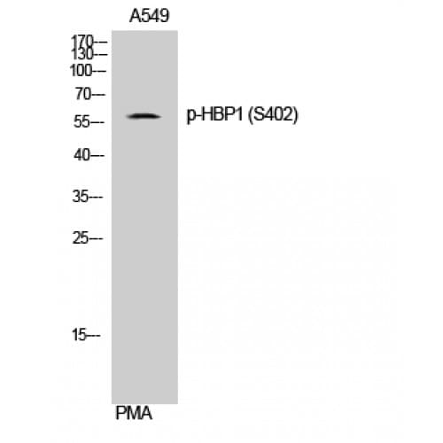 Polyclonal Rabbit anti-Human HBP1 Antibody (phospho-Ser402, IHC, WB)