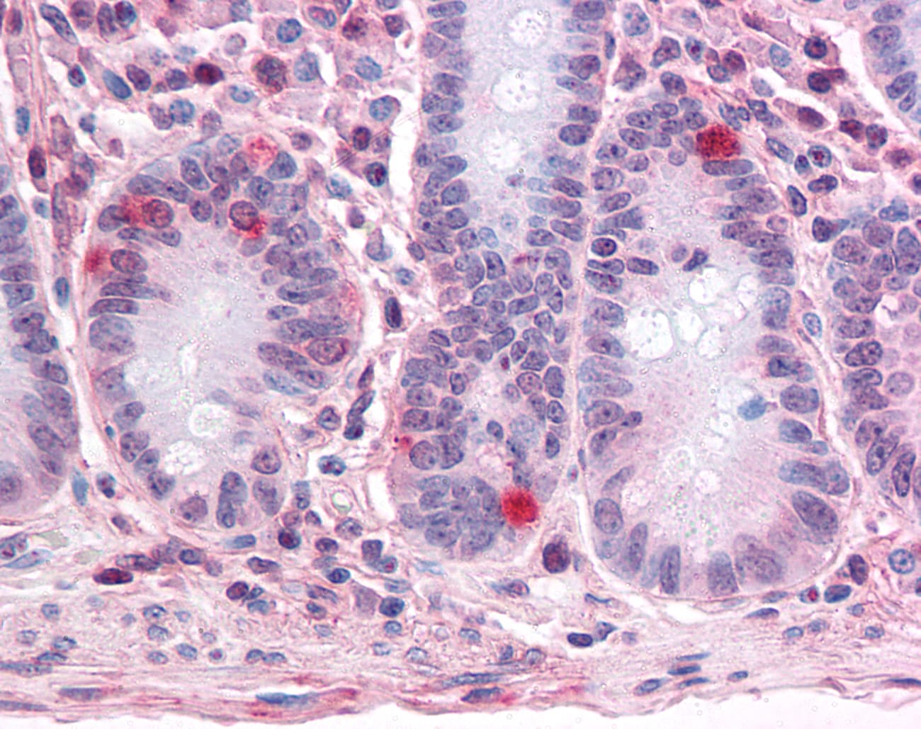 IHC-plus™ Polyclonal Rabbit anti-Human SEMA4B / Semaphorin 4B Antibody (Internal, IHC)