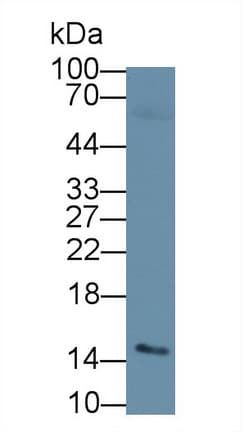 ACYP2 Antibody (aa2-106, APC, Cy7)