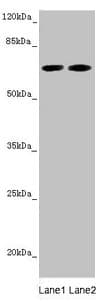 Polyclonal Rabbit anti-Human STXBP2 Antibody (WB)