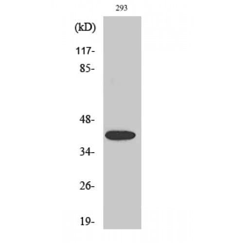 Polyclonal Rabbit anti-Human MAP2K4 / MKK4 Antibody (20-100 aa, IHC, WB)