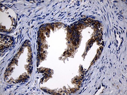 Monoclonal Mouse anti-Human CCDC22 Antibody (clone OTI2E4, Carrier-free, IHC, WB)