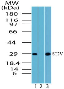 Polyclonal Rabbit anti-Human IL1RL1 Antibody (aa207-220, WB)