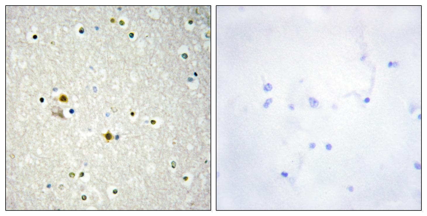 Polyclonal Rabbit anti-Human LIG1 / DNA Ligase 1 Antibody (IHC, WB)
