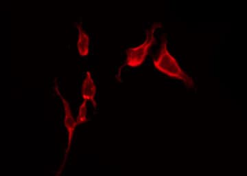 SLC6A1 / GAT-1 Antibody