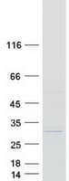 Human ETFBKMT Protein (Recombinant Myc-DDK (Flag))
