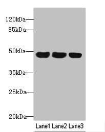 Polyclonal Rabbit anti-Human TXNDC5 / ERP46 Antibody (IHC, WB)