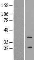 GCAP3 / GUCA1C Protein (Over-Expression Lysate Myc-DDK (Flag))