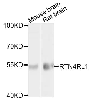 RTN4RL1 / NGRH2 Antibody