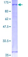 Human CDH18 / Ey-Cadherin Protein (Recombinant GST)